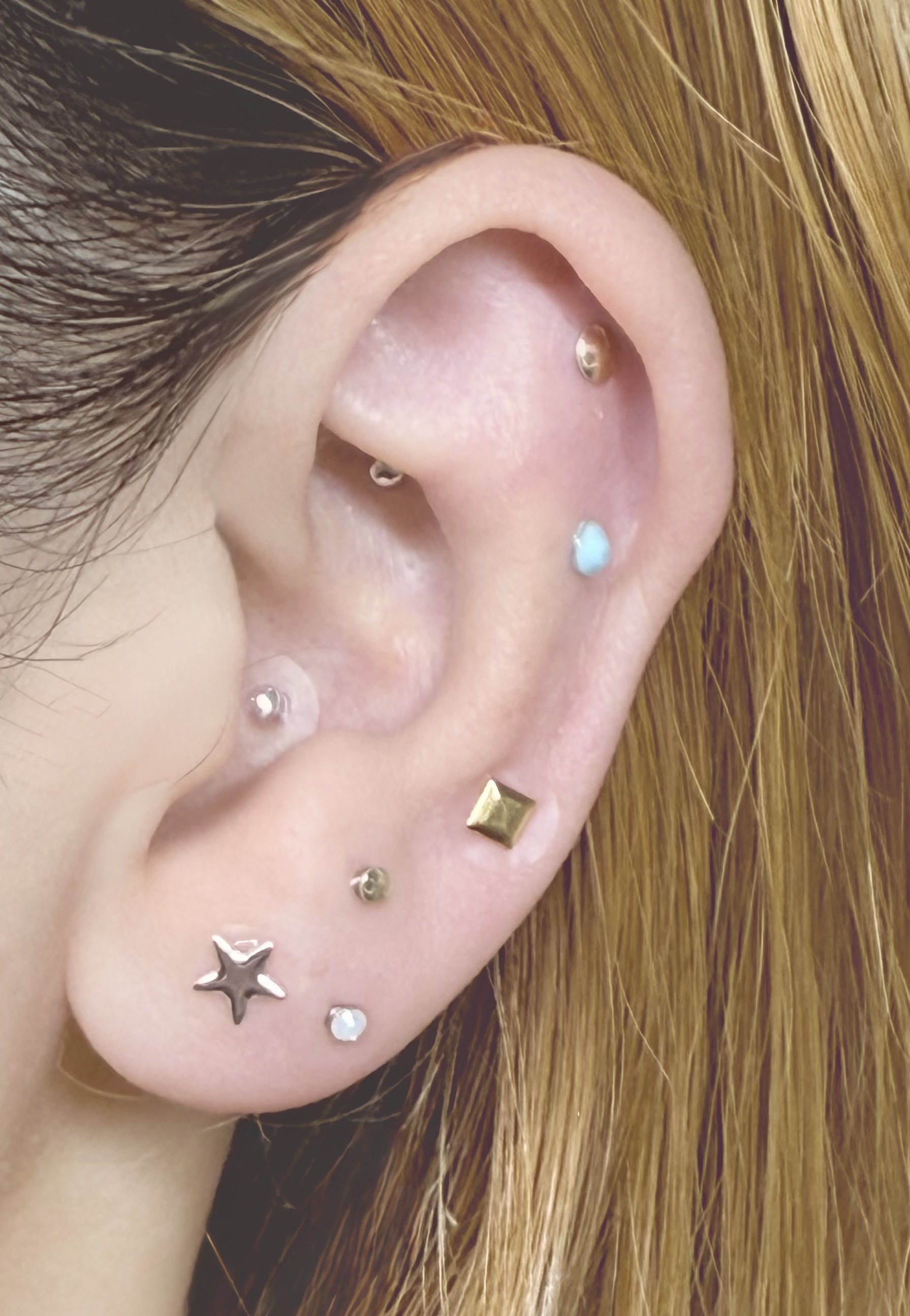 ear_beauty_therapy_img01